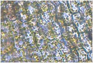 Zellen der Wasserpest mit Chloroplasten
